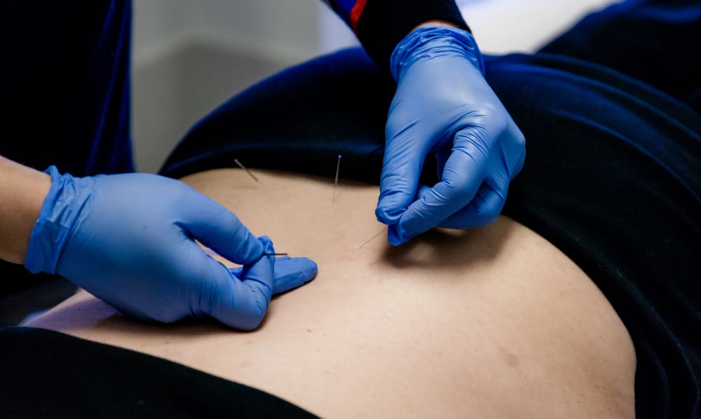 Acupuncture, Ottawa